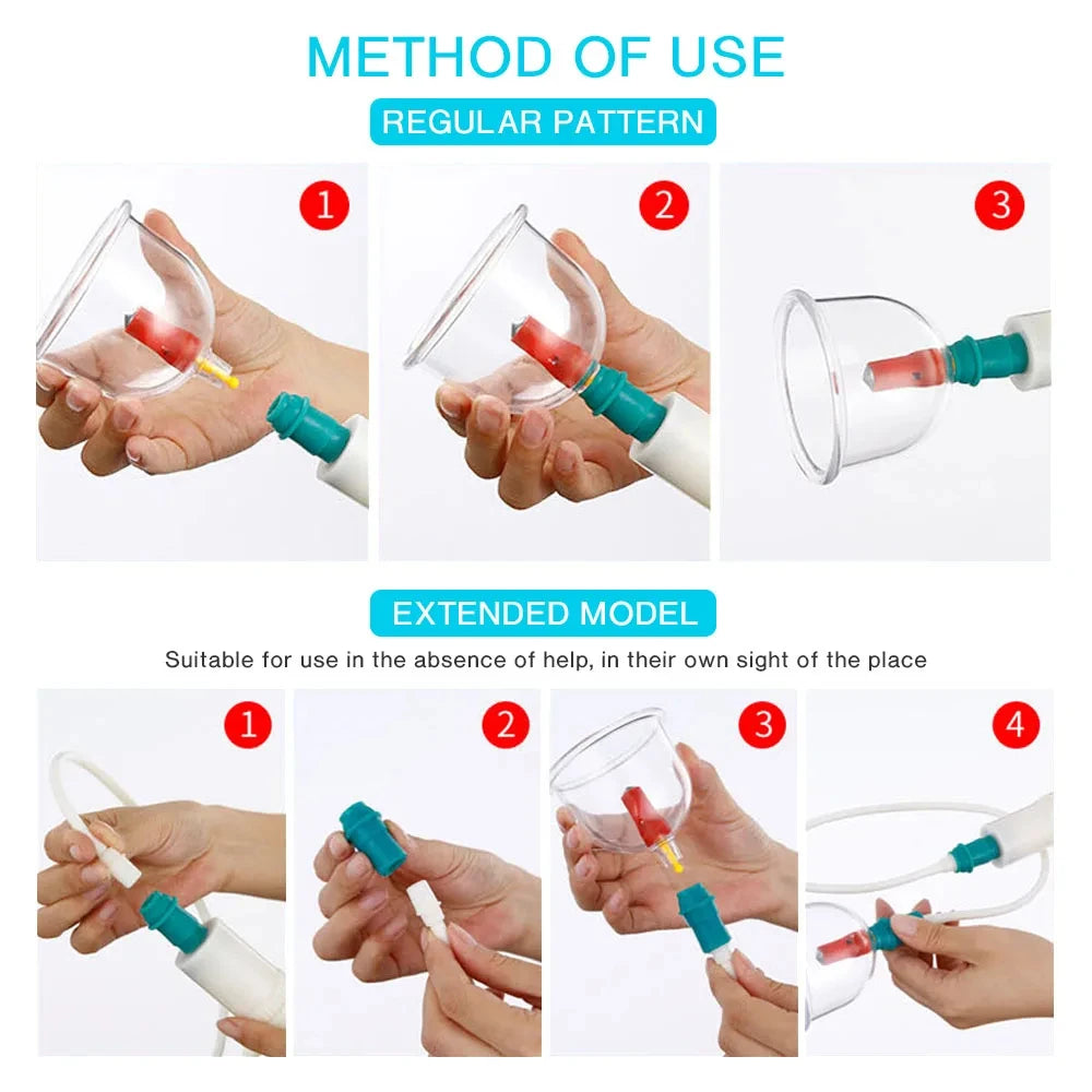 Cupping Therapy Set