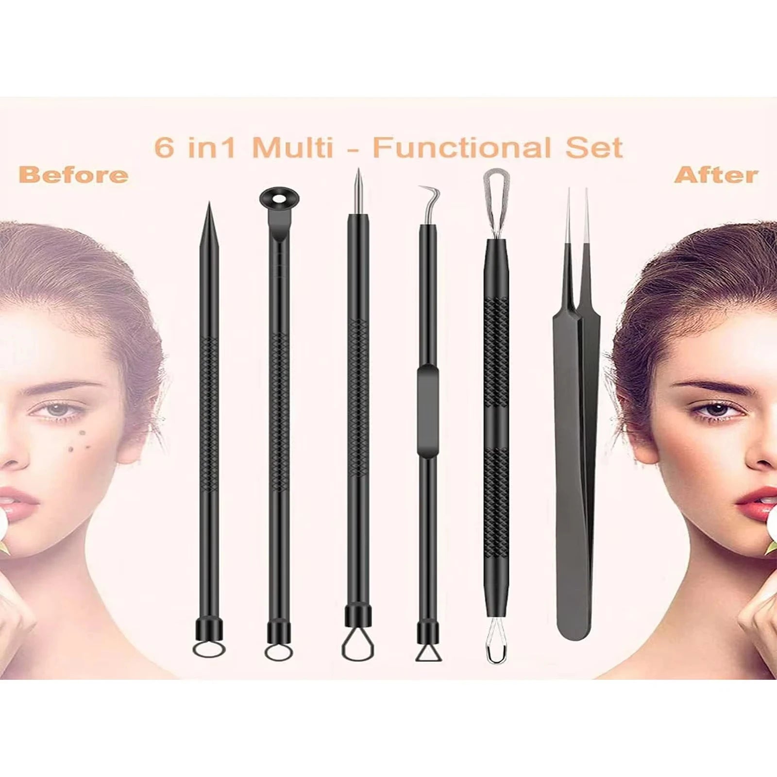 6pcs/set Acne Removal Set